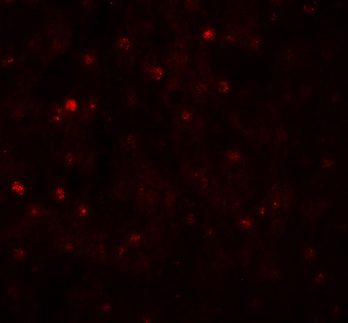 3 - TCTEX1D4 Antibody ASC11519