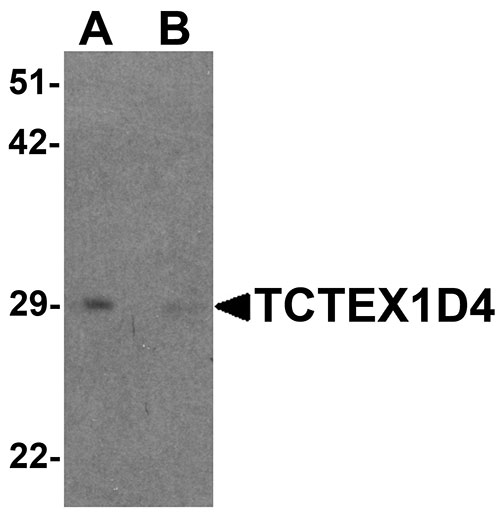 1 - TCTEX1D4 Antibody ASC11519