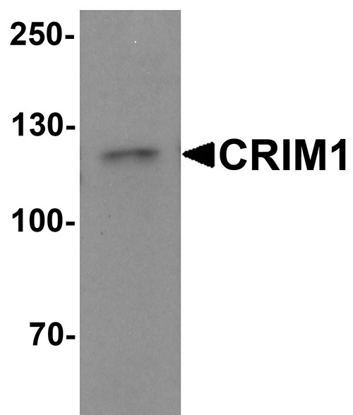 1 - CRIM1 Antibody ASC11521