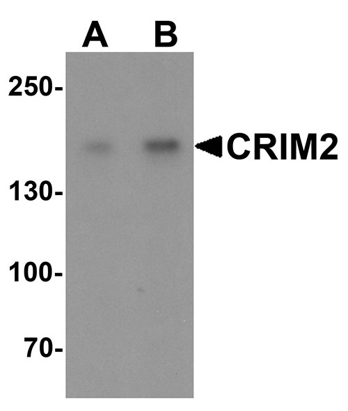1 - CRIM2 Antibody ASC11522