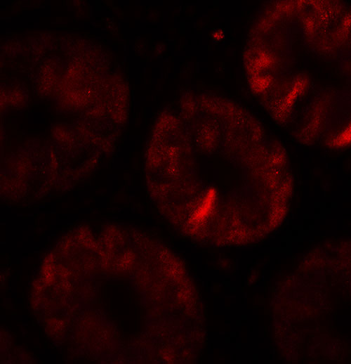 3 - TOX Antibody ASC11529