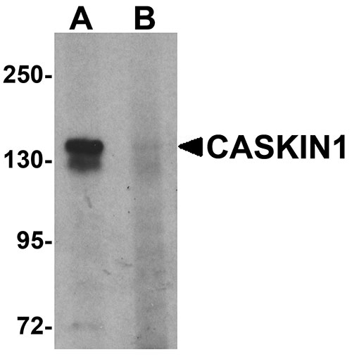 1 - CASKIN1 Antibody ASC11530