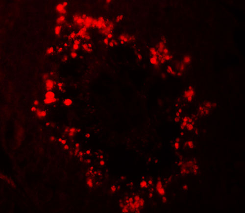 3 - RGS22 Antibody ASC11532