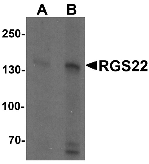 1 - RGS22 Antibody ASC11532