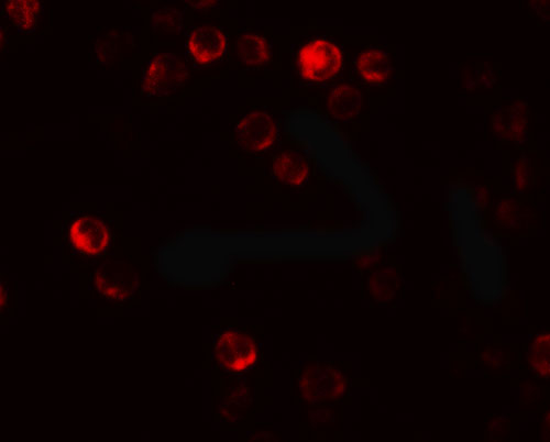 3 - ATG2B Antibody ASC11534