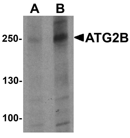 1 - ATG2B Antibody ASC11534