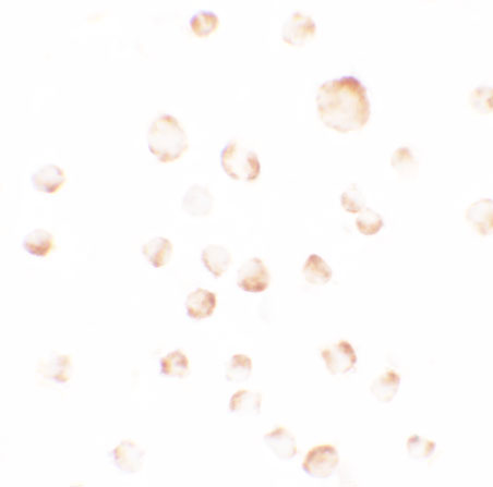 8 - PHLPP1 Antibody ASC11540