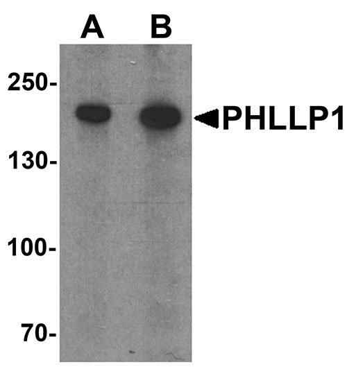 1 - PHLPP1 Antibody ASC11540