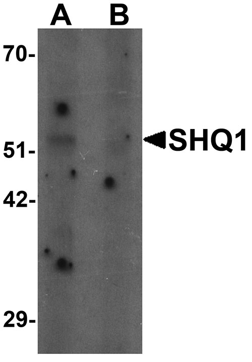 1 - SHQ1 Antibody ASC11545
