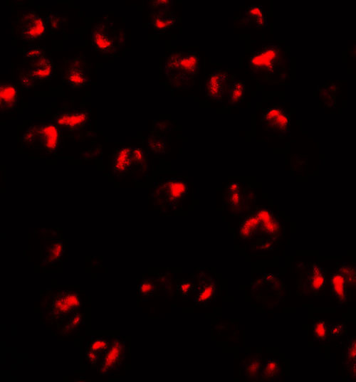 3 - TNFAIP2 Antibody ASC11554