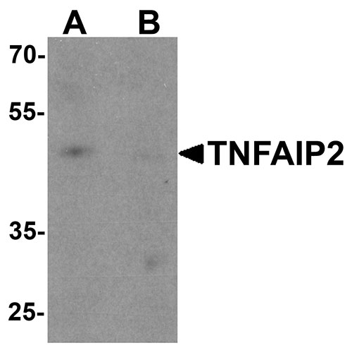 1 - TNFAIP2 Antibody ASC11554