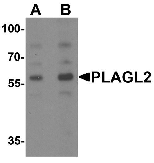 1 - PLAGL2 Antibody ASC11555