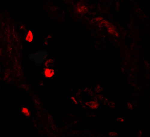 3 - LNPEP Antibody ASC11556