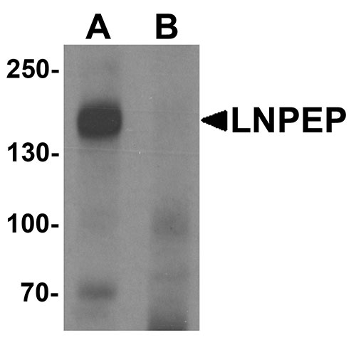 1 - LNPEP Antibody ASC11556