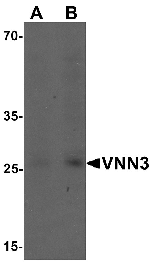 1 - VNN3 Antibody ASC11557