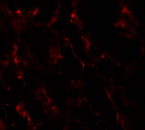 3 - GHDC Antibody ASC11559