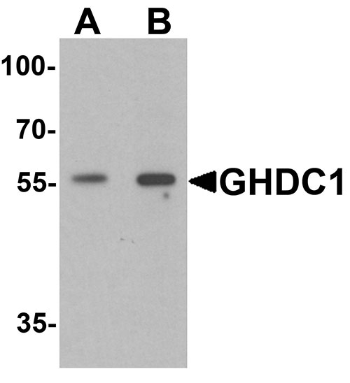 1 - GHDC Antibody ASC11559