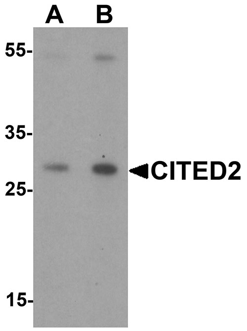 1 - CITED2 Antibody ASC11561