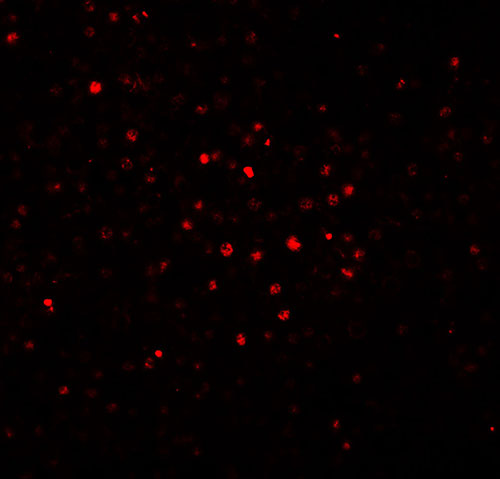 3 - BATF Antibody ASC11562