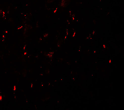 3 - MYT1L Antibody ASC11567