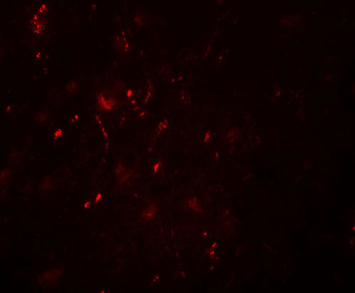3 - POU3F2 Antibody ASC11568