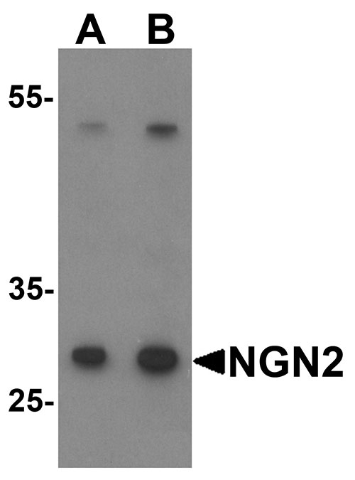 1 - NGN2 Antibody ASC11571