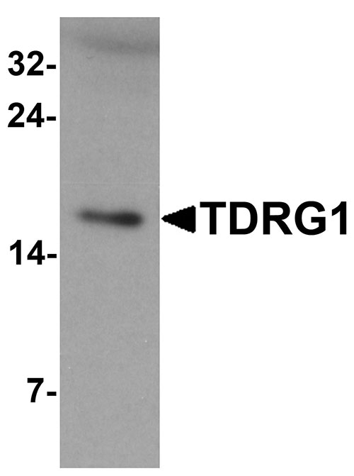 1 - TDRG1 Antibody ASC11578