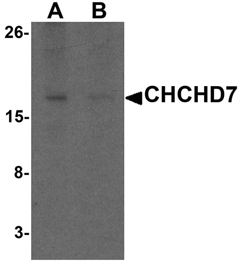 1 - CHCHD7 Antibody ASC11585