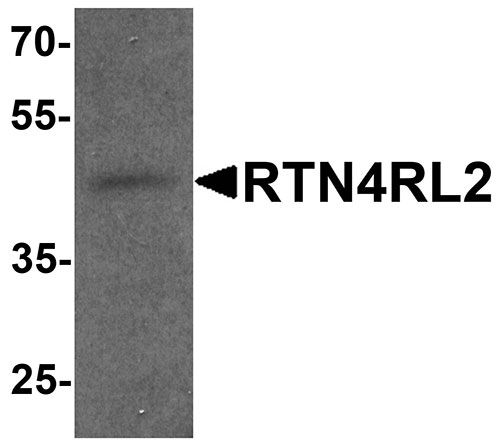 1 - RTN4RL2 Antibody ASC11586