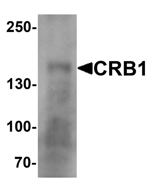 1 - CRB1 Antibody ASC11589