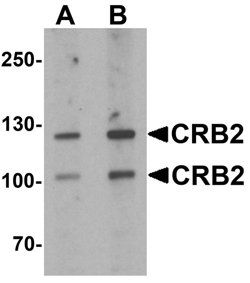 1 - CRB2 Antibody ASC11590