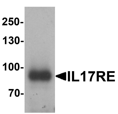 1 - IL-17RE Antibody ASC11598