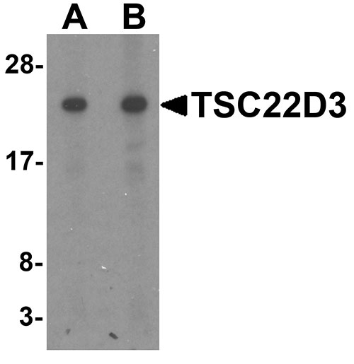1 - TSC22D3 Antibody ASC11610