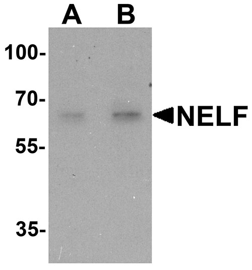 1 - NELF Antibody ASC11612