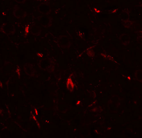 3 - GRIP1 Antibody ASC11614