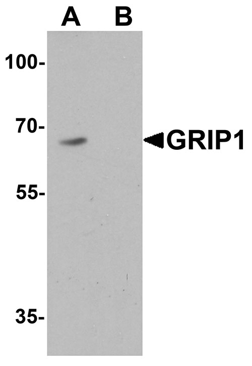 1 - GRIP1 Antibody ASC11614