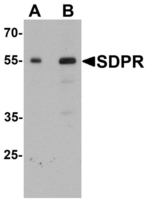 1 - PTRF Antibody ASC11629