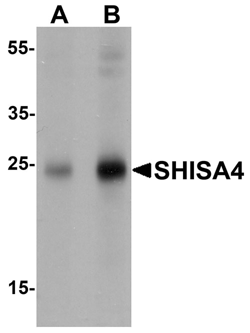 1 - SHISA4 Antibody ASC11633