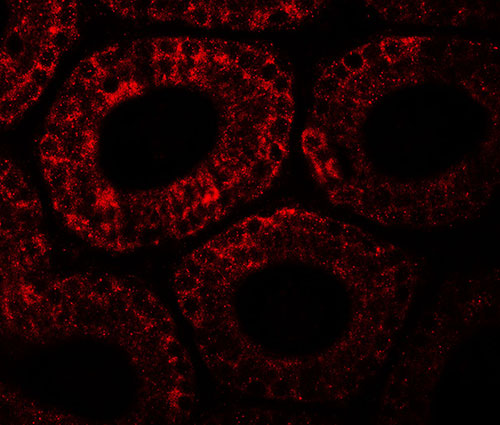 3 - MOSPD1 Antibody ASC11634