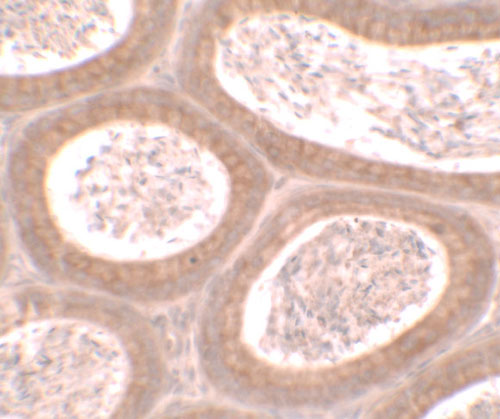 2 - MOSPD1 Antibody ASC11634