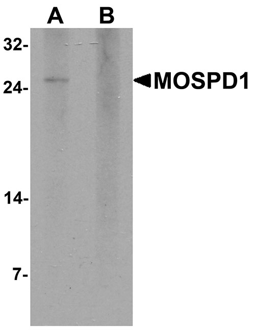 1 - MOSPD1 Antibody ASC11634