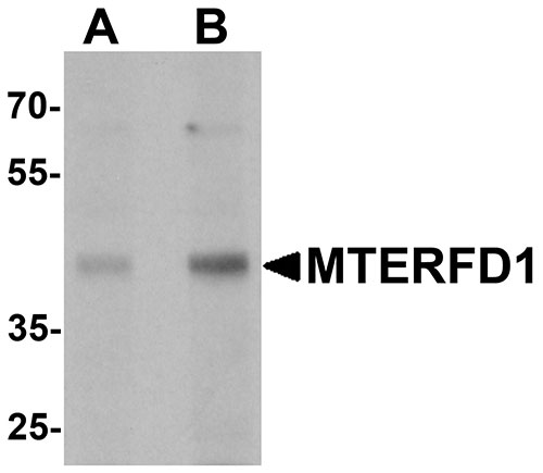 1 - MTERFD1 Antibody ASC11635