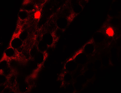 3 - MTERFD2 Antibody ASC11636
