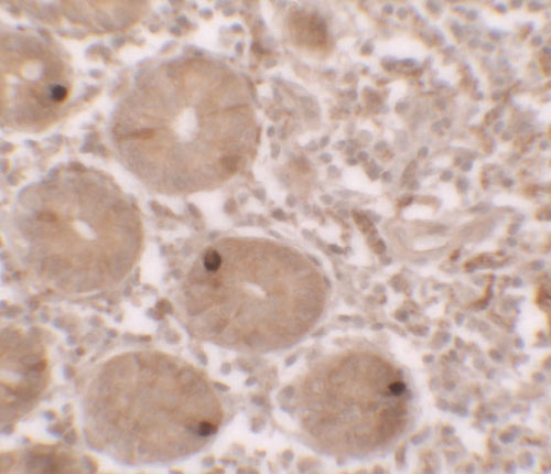 2 - MTERFD2 Antibody ASC11636