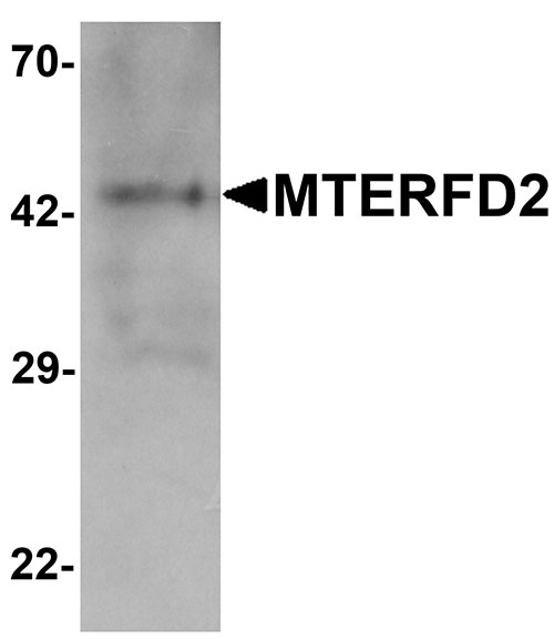 1 - MTERFD2 Antibody ASC11636