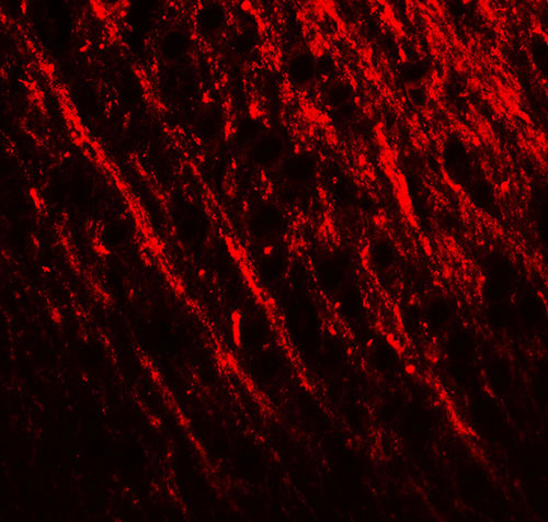 3 - PRRT2 Antibody ASC11641