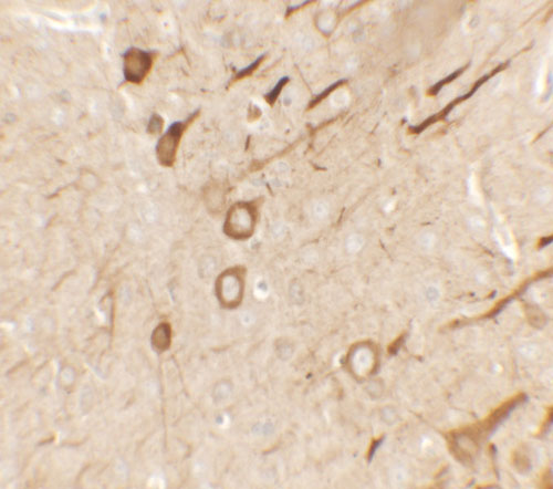 2 - PRRT2 Antibody ASC11641