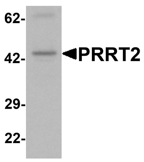1 - PRRT2 Antibody ASC11641