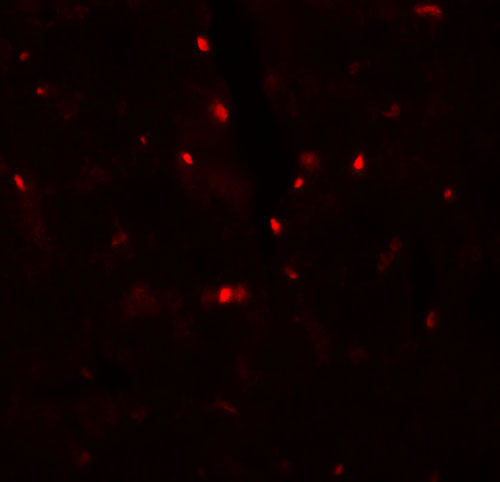 3 - SLC27A6 Antibody ASC11642