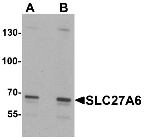 1 - SLC27A6 Antibody ASC11642